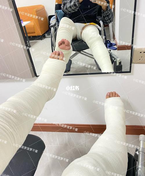 2025澳门特马开奖结果和被狗主人殴打致骨折与狗被打骨折了怎么办